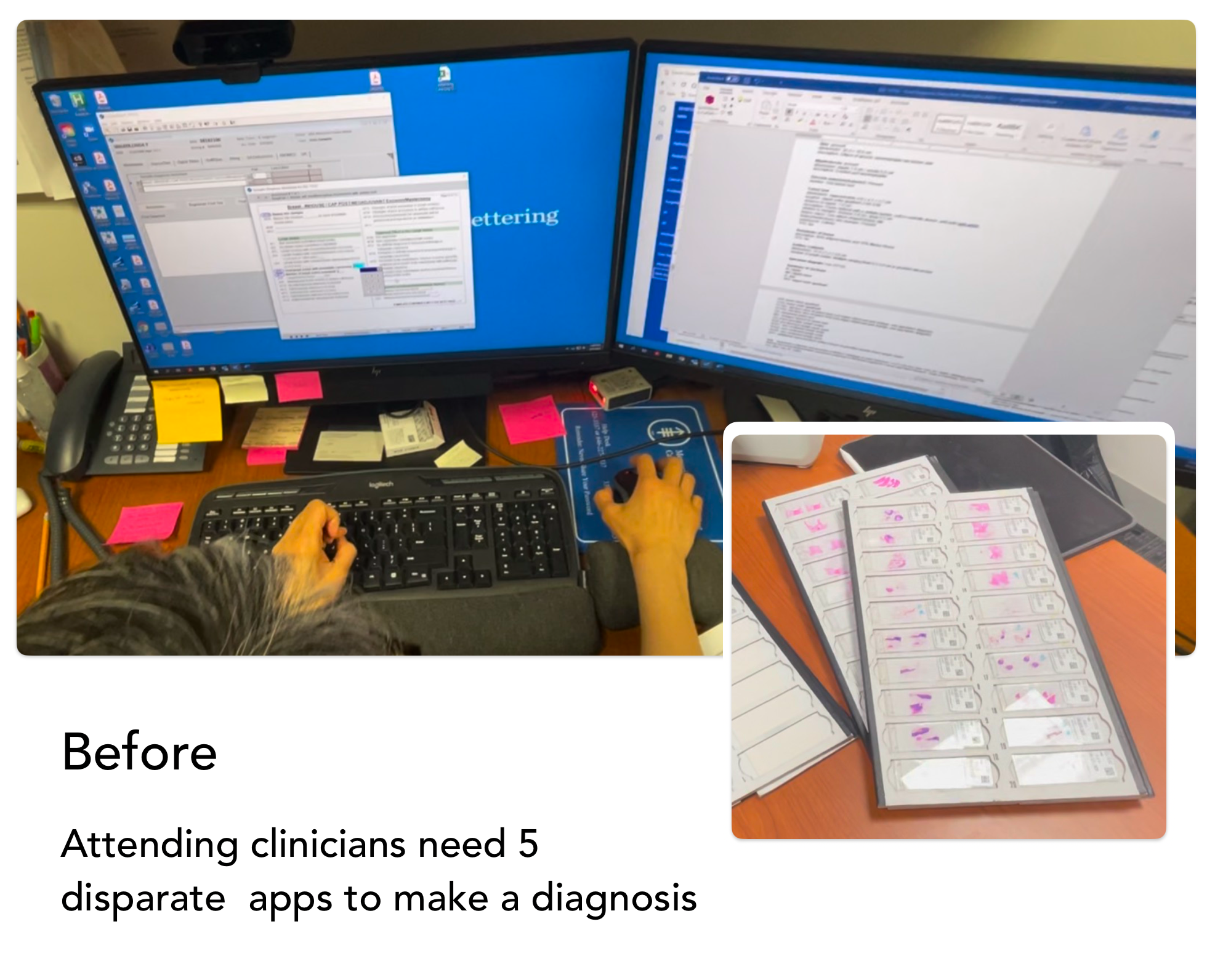 Attending clinicians need disparate 5 apps to complete a sign-out 